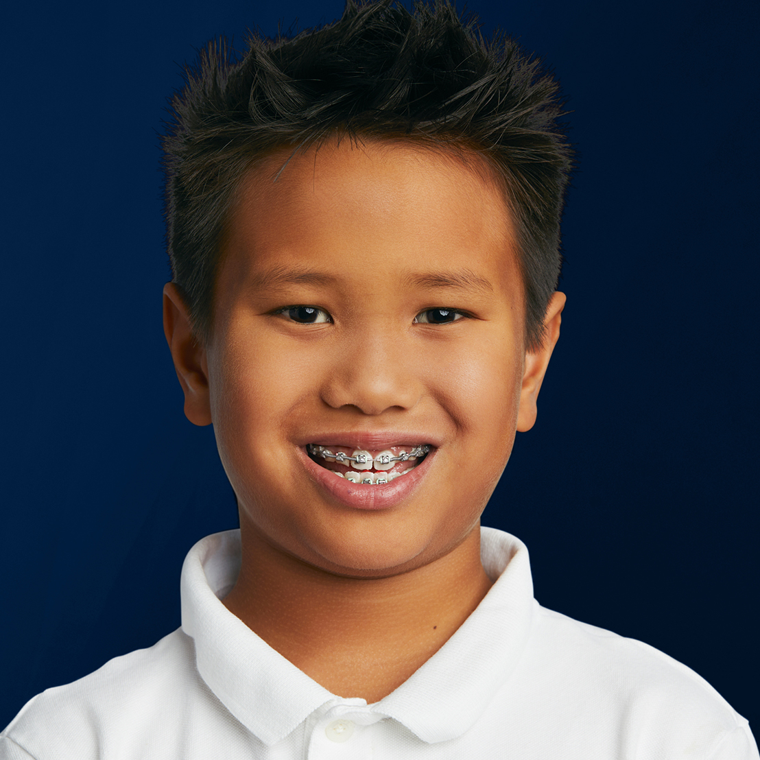 Braces Near Chicago Traditional & Ceramic Braces for All Ages