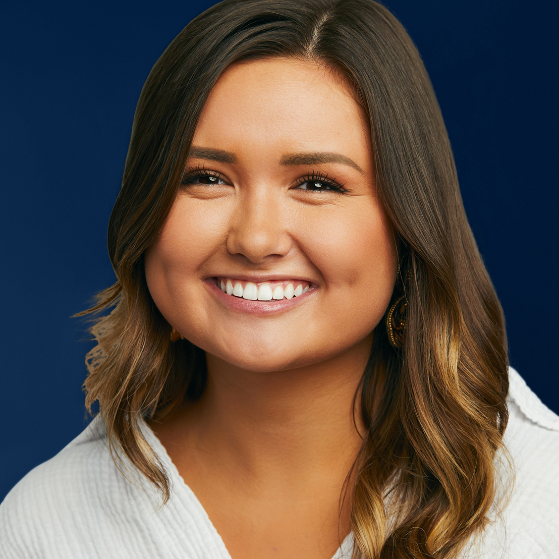 Invisalign Results After 6 Months! | Smile Express® At-Home Aligners